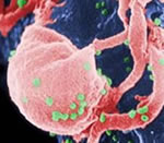 Electron microscope image of HIV