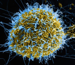 A colorized, magnified electron microscope image of the Ebola virus growing out of an infected VERO 46 cell. Image by National Institute of Allerfy and Infectious Disease